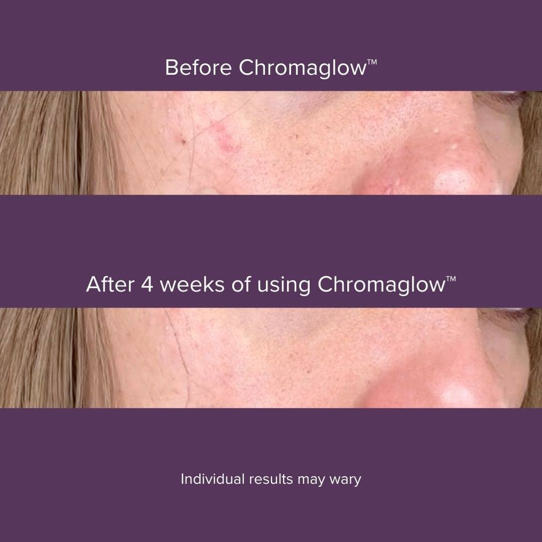 Luyors - Chromaglow™ 7 Color Skincare Wand