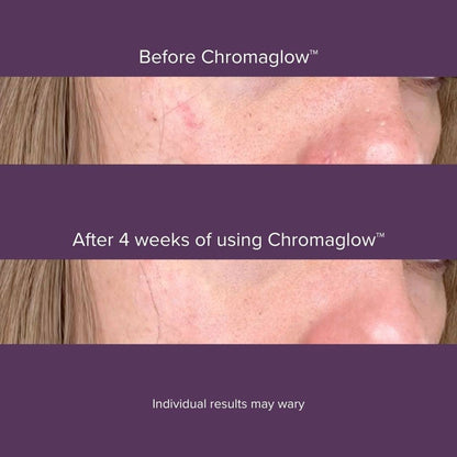 Luyors - Chromaglow™ 7 Color Skincare Wand